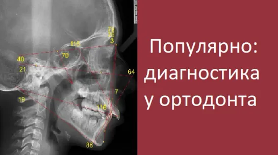 Популярно: диагностика в ортодонтии.