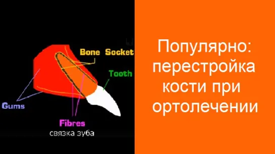 Популярно: перестройка кости при ортодонтическом лечении на брекетах. Стоматология.