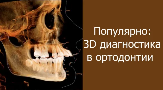 Популярно:  3D диагностика в ортодонтии.Стоматология