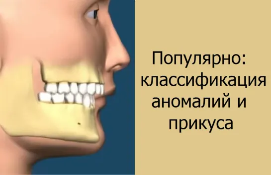 Популярно: классификация аномалий и прикуса. Ортодонтия. Стоматология