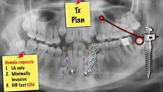 Innovative Impaction Treatment   2018 Part 6. Ортодонтия.