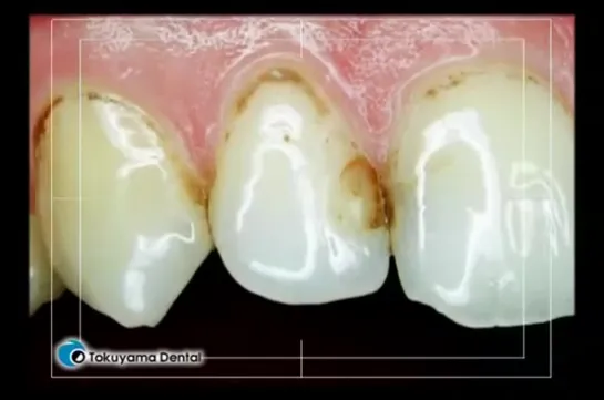 1. Обучающий фильм Tokuyama Dental