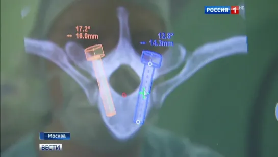 Московские нейрохирурги провели мастер-класс в режиме онлайн