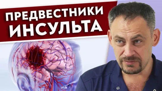 Первые признаки инсульта.  Как предотвратить инсульт?