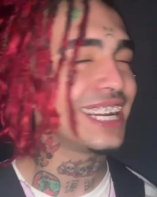 2 grillz in 1 week  Rose gold invisible set by Lil Pump