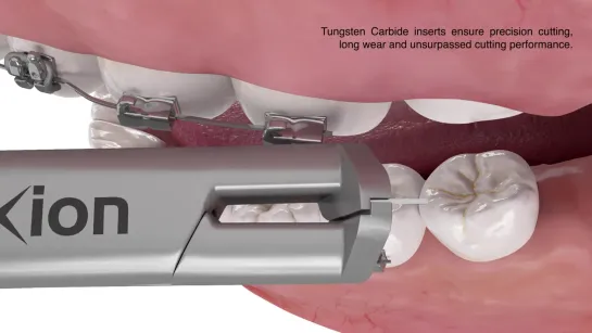 Ixion IX900 - Distal End Cutter. Ортодонтический инструмент.