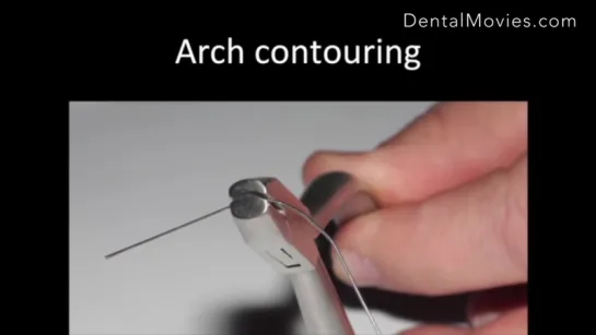 Practical wire bending tips in contemporary orthodontics for ideal case finishing. Ортодонтия.