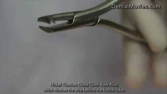 Nickel Titanium Distal Cinch Back Plier."Корейские" щипцы в работе.Ортодонтия.