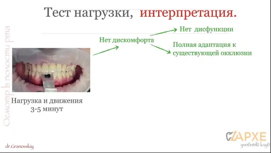 Тест нагрузки с листовым калибратором. Н.Грановский.