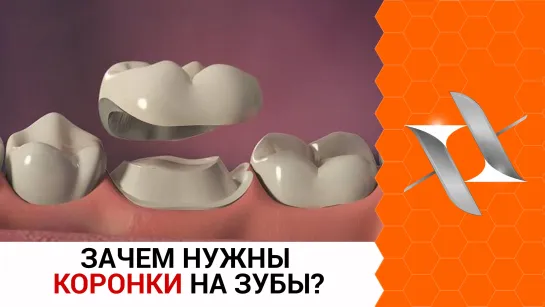 Зачем нужны коронки на зубы? Можно ли сэкономить при этом?