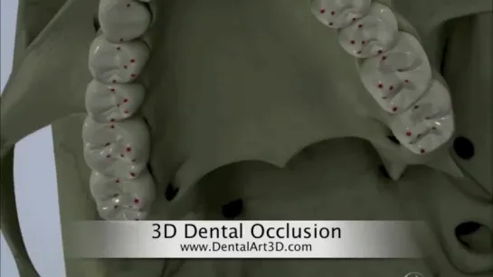 DentalArt3D. 3D Dental Occlusion