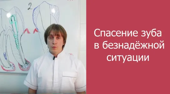 Как Спасти Зуб от Удаления в безнадежном Случае. Виталий Руденко.