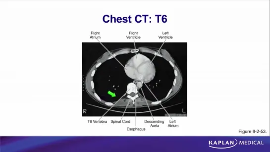 23. Anatomy - Sec II Thorax - Mediastinum