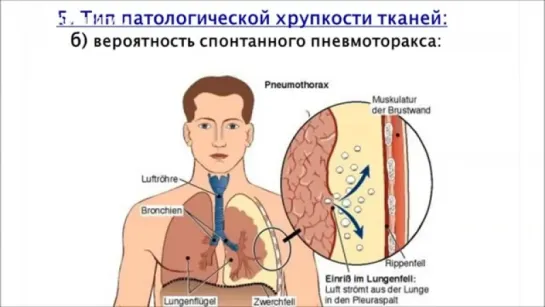 Алексей Селицкий. Алкоголь - влияние на генетику и здоровье людей