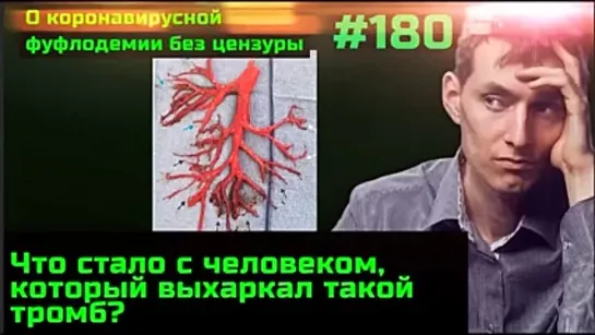 #180 Тромбы. Исчезновение иммунитета за 4 месяца после вакцинации