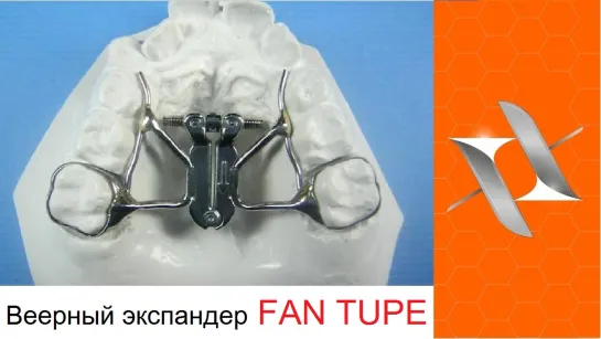 Ортодонтический аппарат для веерного расширения Fan Expander