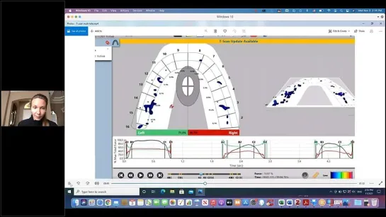 T-scan Multi- bite explained. Как интерпретировать данные записи Т-скан