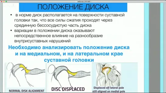 ВНЧС диагностика. TMJ examination