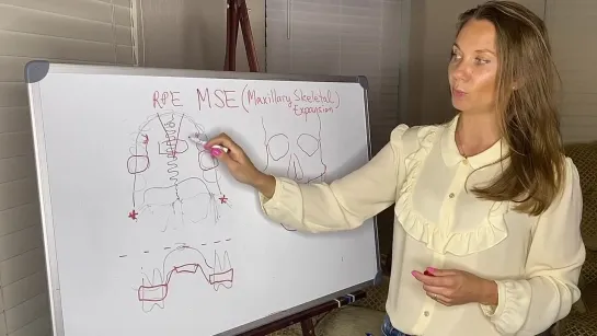 MSE - MARPE. Скелетное небное расширение с опорой на микроимпланты. С.Коваль.