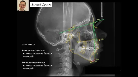 Телерентгенография. Антропометрия. Цефалометрия.  Фролов А. О.Ортодонтия.