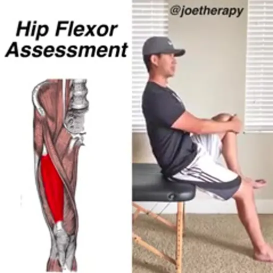 Hip Flexor Assessment