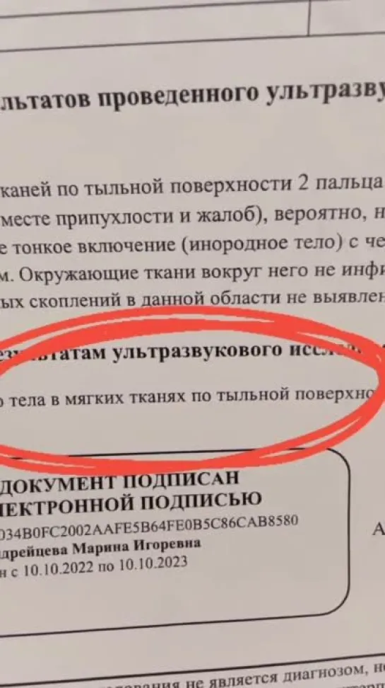 Алексей Воробьёв: Съёмки #БольшеЧемФутбол, спорт, осколок стекла в руке😱stories 06 - 08.08.2023