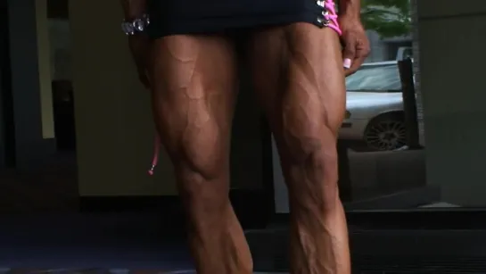 vascular babe