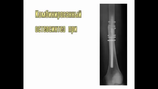 Операции Ангарска