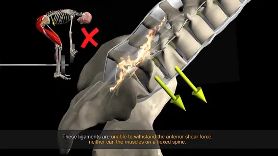 How to Avoid Injuries While Lifting- Watch the muscles in 3D