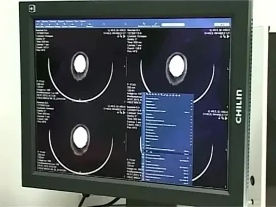 18.02.2013 г. Компьютерная томография в ЦМСЧ-38