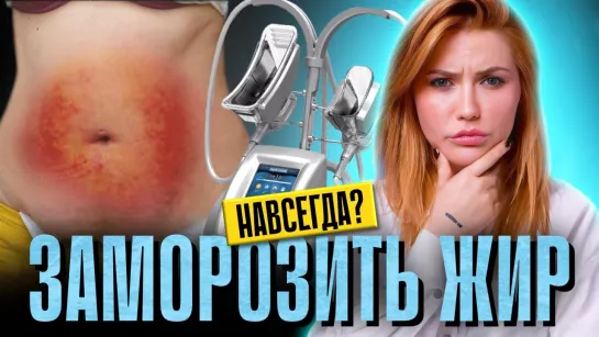 ПОХУДЕНИЕ ХОЛОДОМ | Чем опасен криолиполиз?