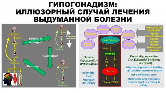 ГИПОГОНАДИЗМ: ИЛЛЮЗОРНЫЙ СЛУЧАЙ ЛЕЧЕНИЯ ВЫДУМАННОЙ БОЛЕЗНИ | Александр Мирошников