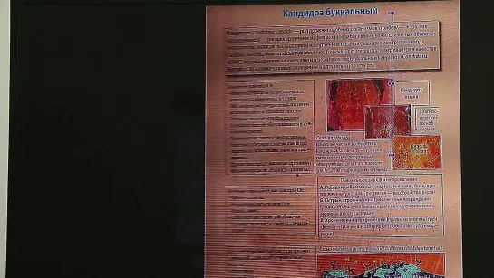 Как помочь себе при хроническом гайморите? [Шишова О.И.]