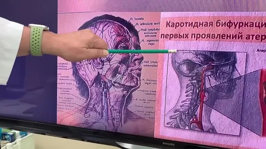 Причина головных болей и шума в ушах и ее устранение. [Шишова О.И.]