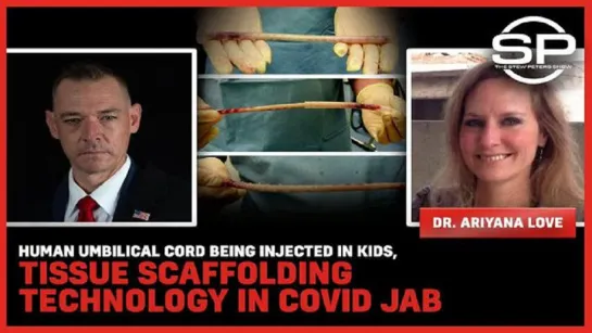 Human umbilical cord being injected in kids: Tissue scaffolding technology in COVID jab