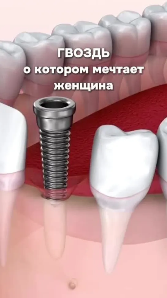 Video by Стоматологическая клиника Astra Dental Clinic