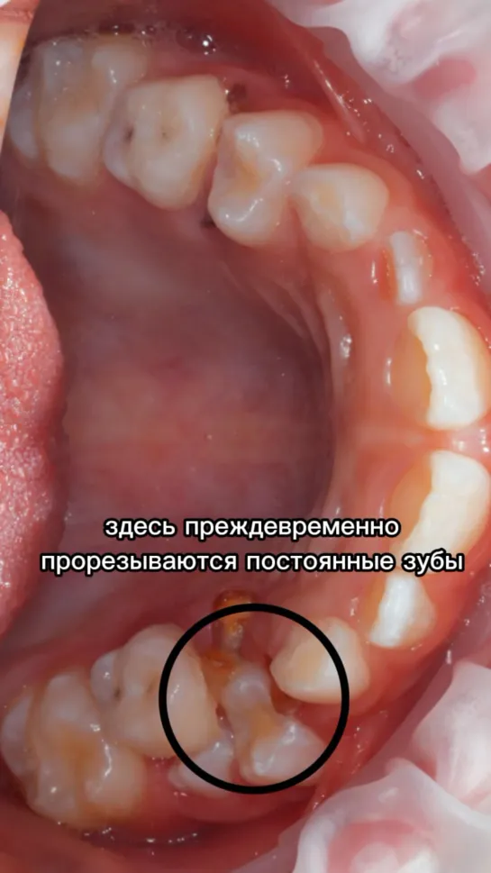 Video by Стоматологическая клиника Astra Dental Clinic