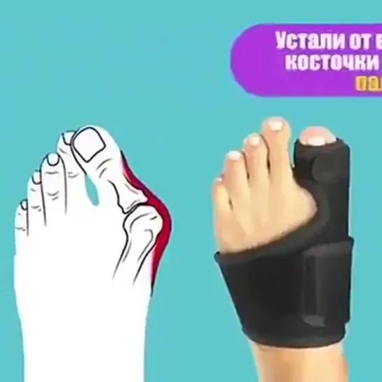 Выпрями большой палец