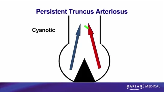 19. Anatomy - Sec II Thorax - Fetal Heart Abnormalities