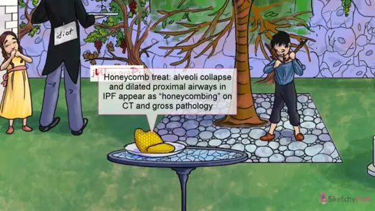 2.2 - Idiopathic Pulmonary Fibrosis (IPF)