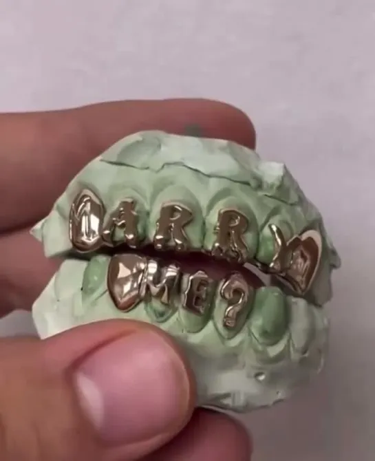 A$AP Ricky’s «MARRY ME» grills?✨