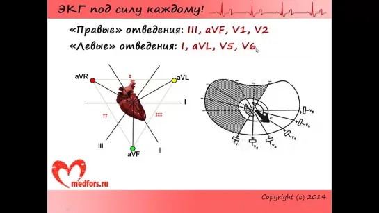 Урок 7. Видеокурс ЭКГ под силу каждому