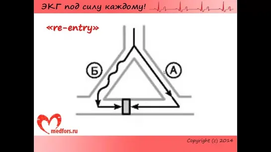 Урок 5. Видеокурс ЭКГ под силу каждому