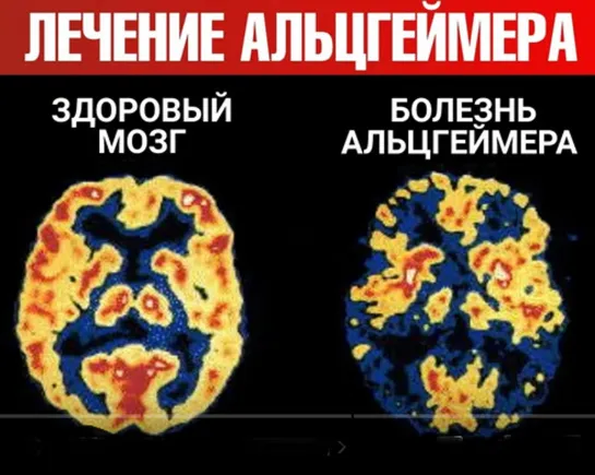 Оргазм - это энергия Кундалини поднимающаяся из копчика в мозг.