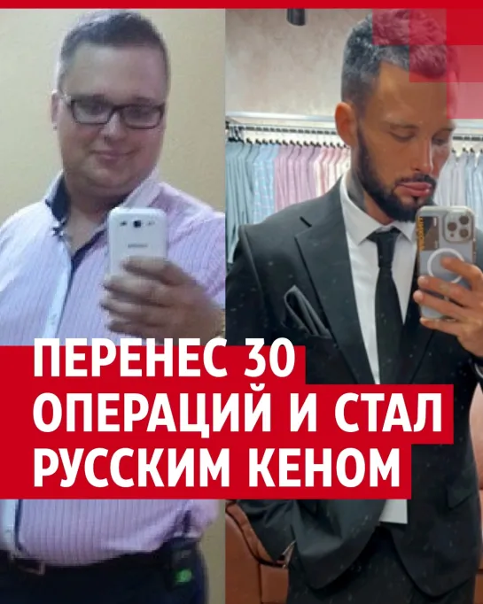 «Русский Кен» сделал больше 30 операций