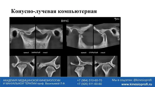 Кинезиостеопсихопрактика в стоматологии. Илья Чебодаев