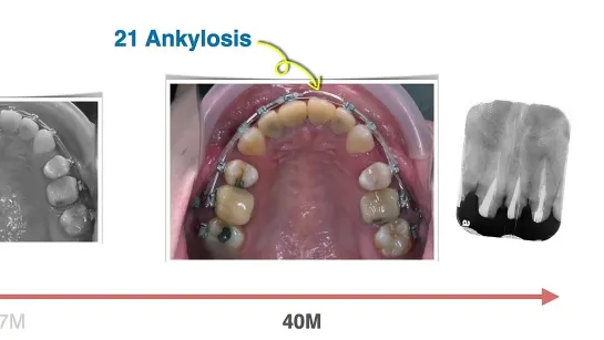 Chris Chang Ortho. Case Report. Ортодонтия