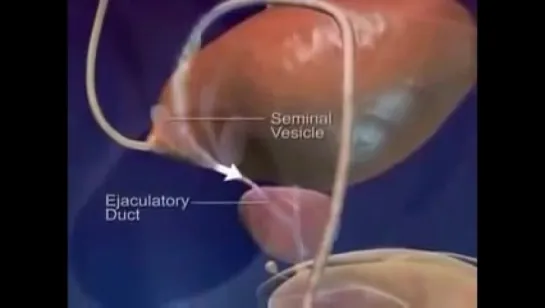Как выходит сперма Эякуляция. Анимация