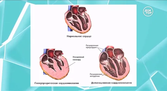 Здоровье