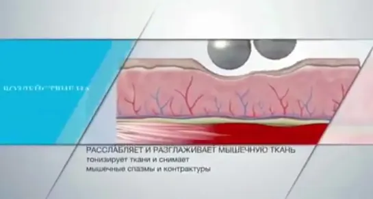 Революция, которая не имеет аналогов - #EndospheresTherapy!
•  формирует силуэт
•  борется с целлюлитом
•  способствует снижению